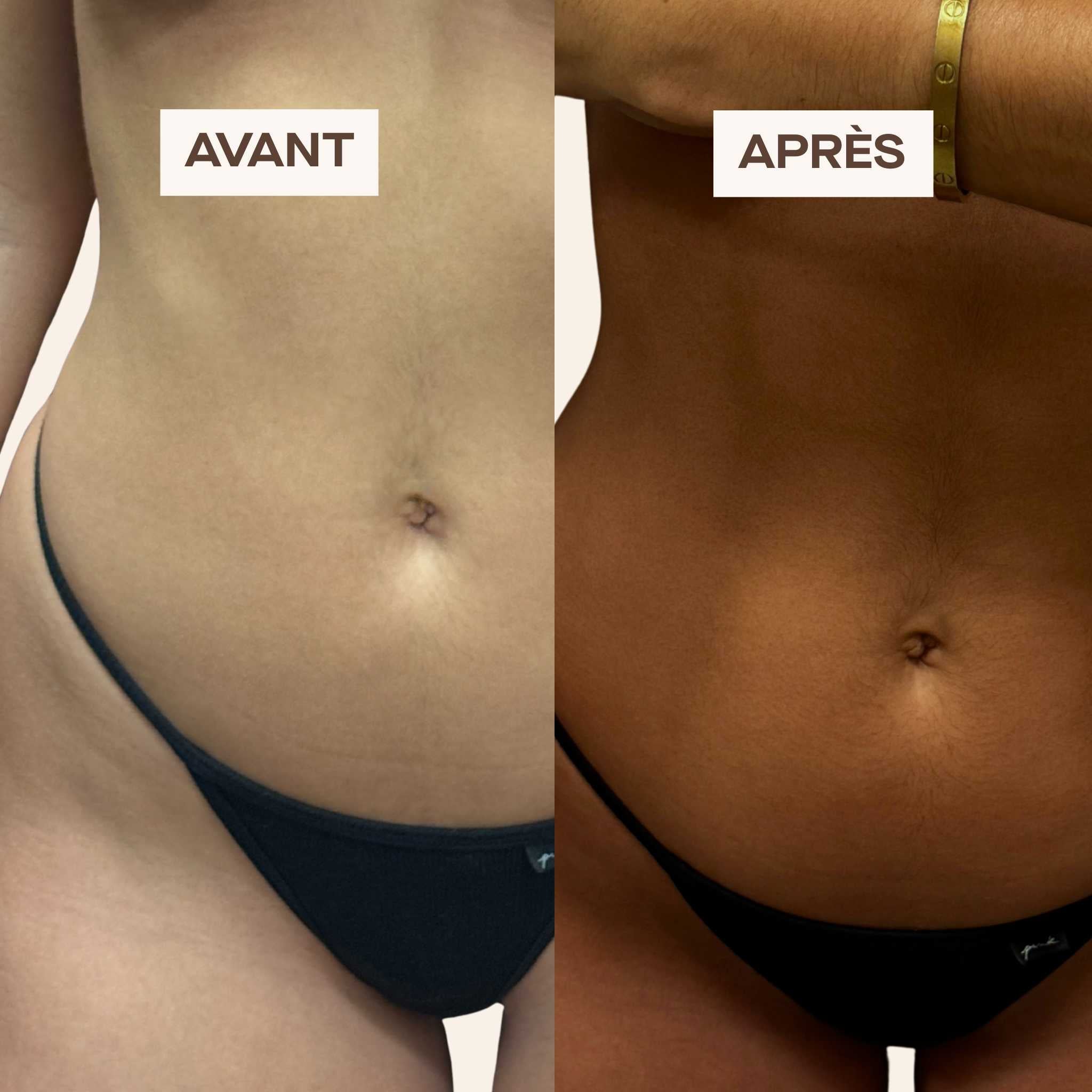 Red Carpet Bundle (French) 